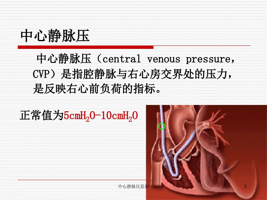 中心静脉压监测课件_第3页