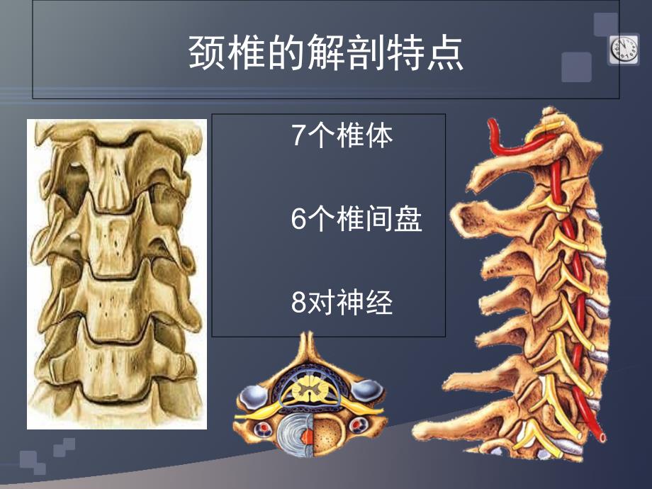 颈椎病的CT诊断PPT课件_第3页