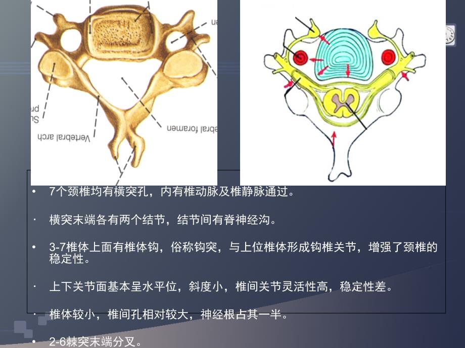 颈椎病的CT诊断PPT课件_第4页