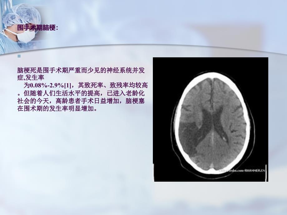 围手术期脑梗ppt课件_第2页