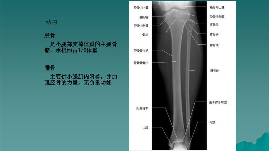 胫腓骨骨折护理2干货分享_第4页