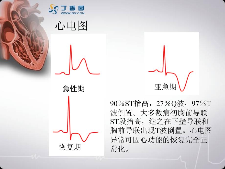 浅论心肌气球样变课件_第4页