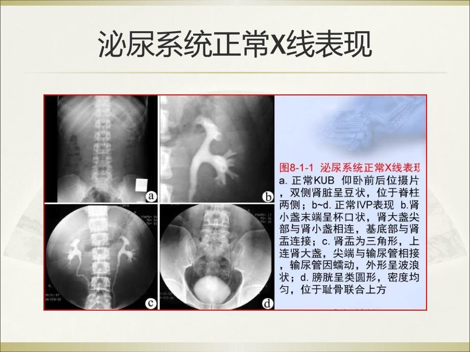 泌尿生殖系统和腹膜后间隙断层解剖.ppt_第4页