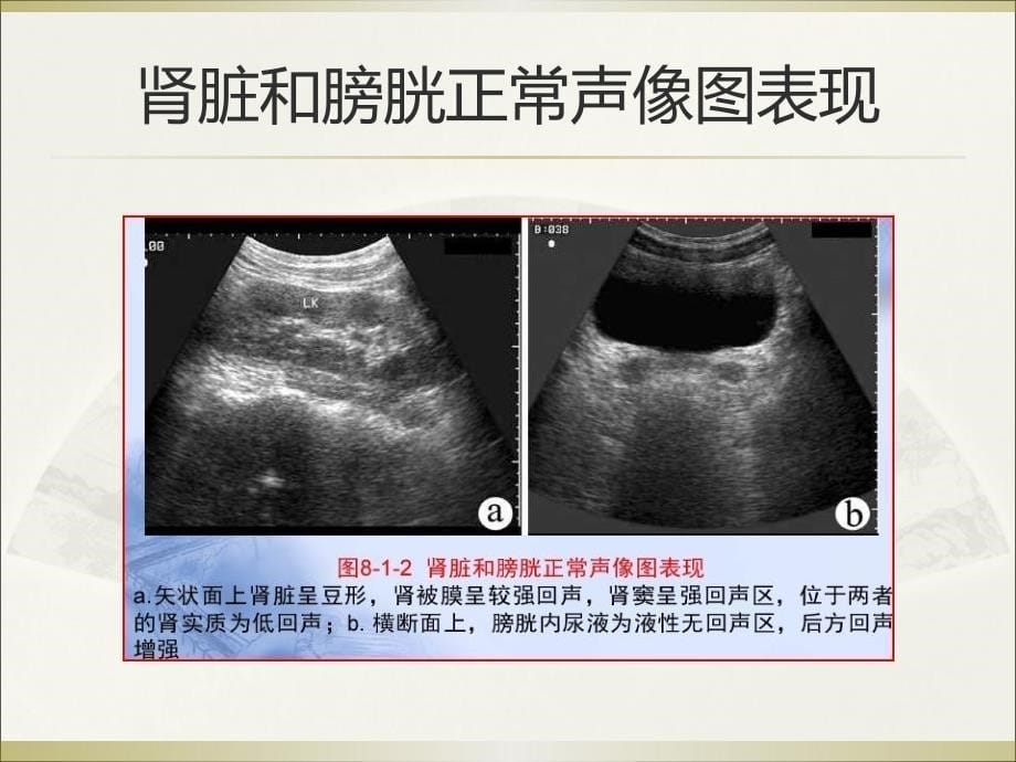 泌尿生殖系统和腹膜后间隙断层解剖.ppt_第5页