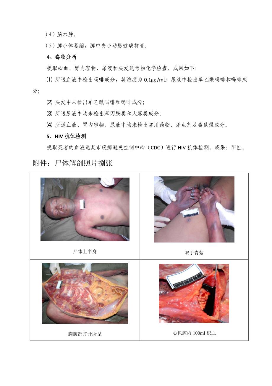 法医学案例分析及答案_第4页