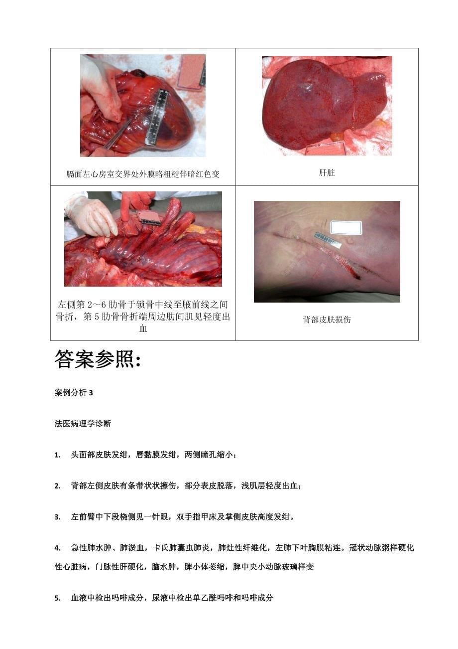 法医学案例分析及答案_第5页