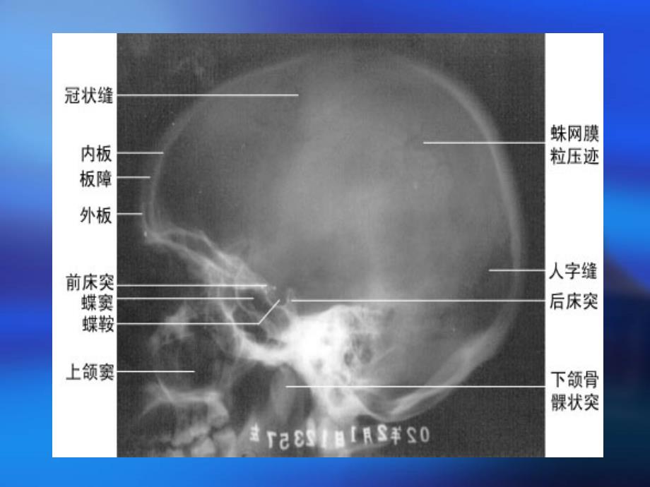 影像学中枢神经系统1教学教材_第4页