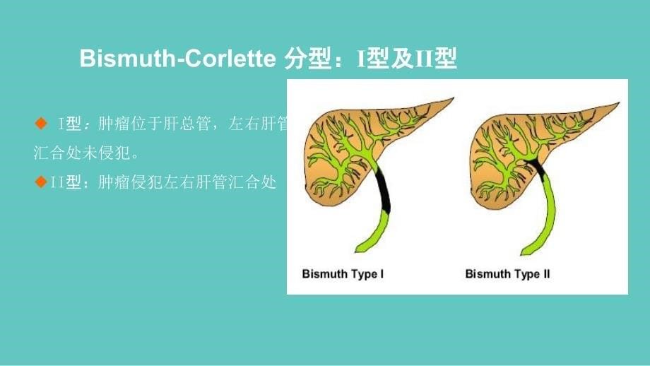 肝门部胆管癌的分型与手术策略_第5页