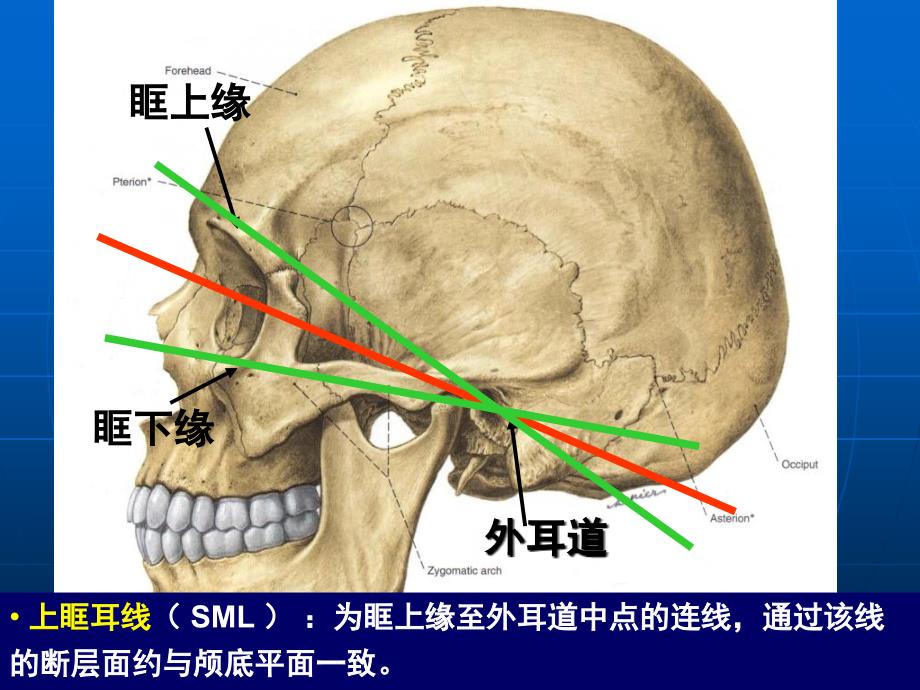 头颅CT基本知识与常见疾病_第4页