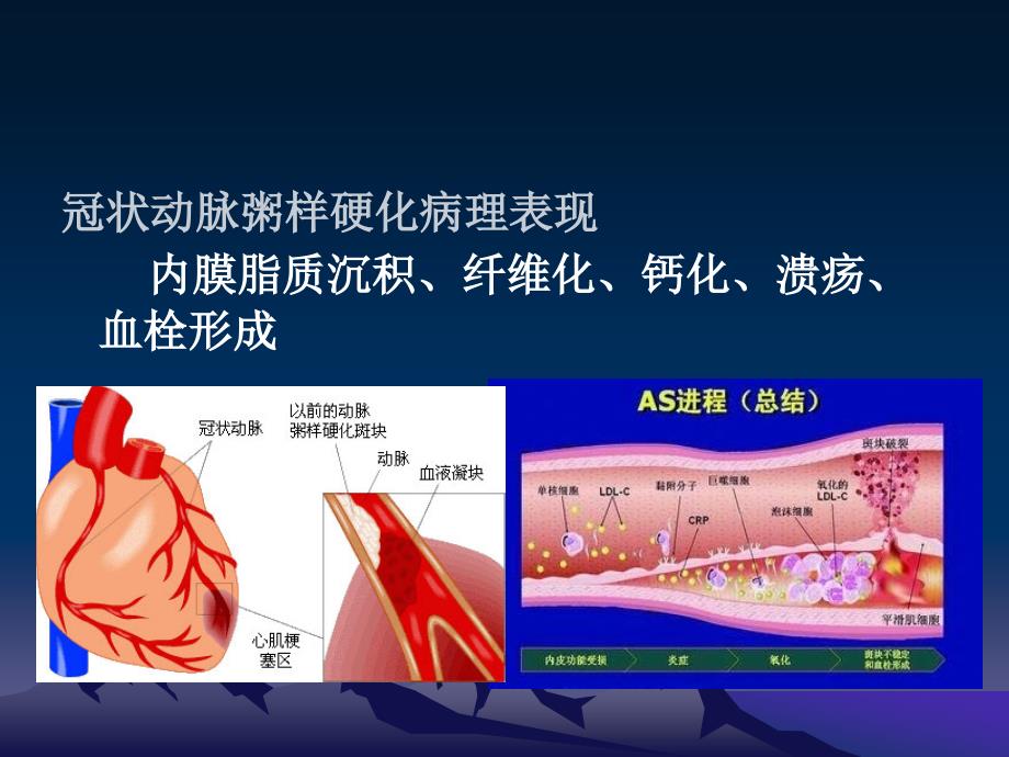 常见心肌病的超声诊断_第4页