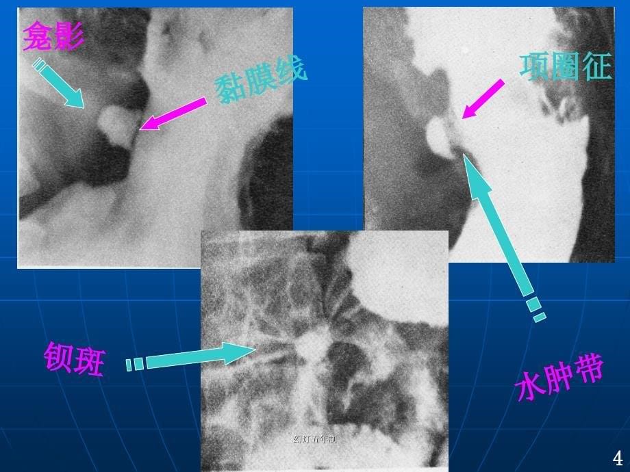 幻灯五年制课件_第5页