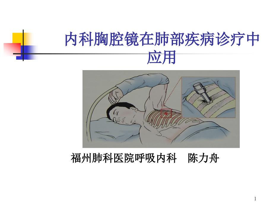 内科胸腔镜ppt课件_第1页