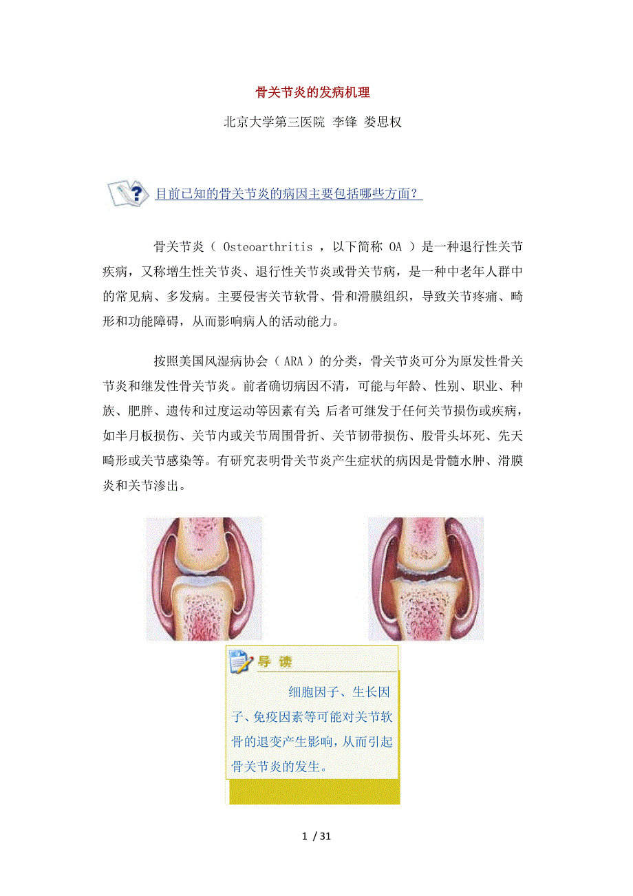 骨关节炎的发病机理_第1页