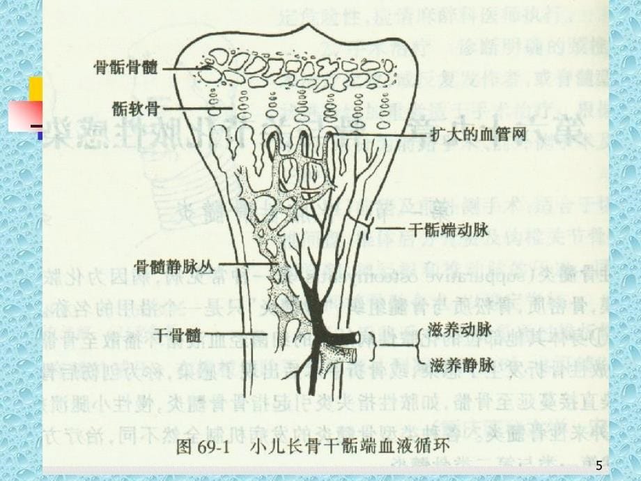 骨关节感染和结核课堂PPT_第5页