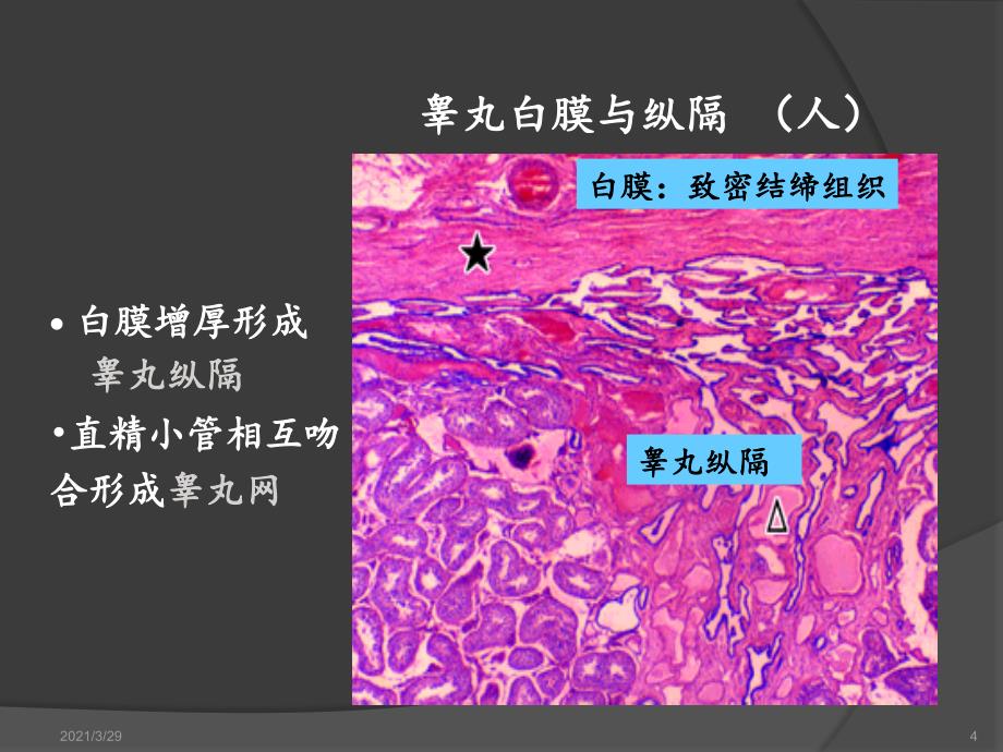 组胚男性生殖系统优秀课件_第4页