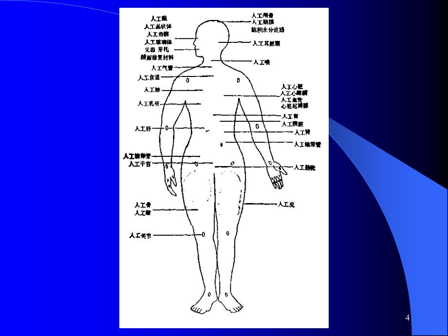 医学课件人工器官医学课件_第4页