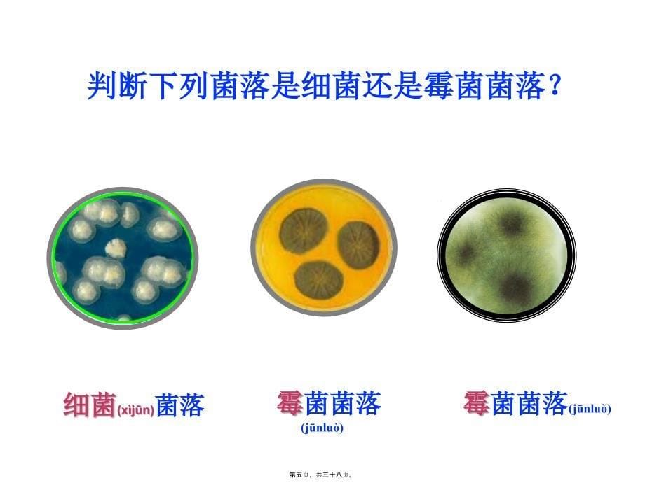 医学专题—细菌和真菌的分布1_第5页