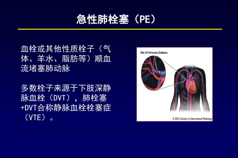 肺栓塞诊断及鉴别诊断_第2页