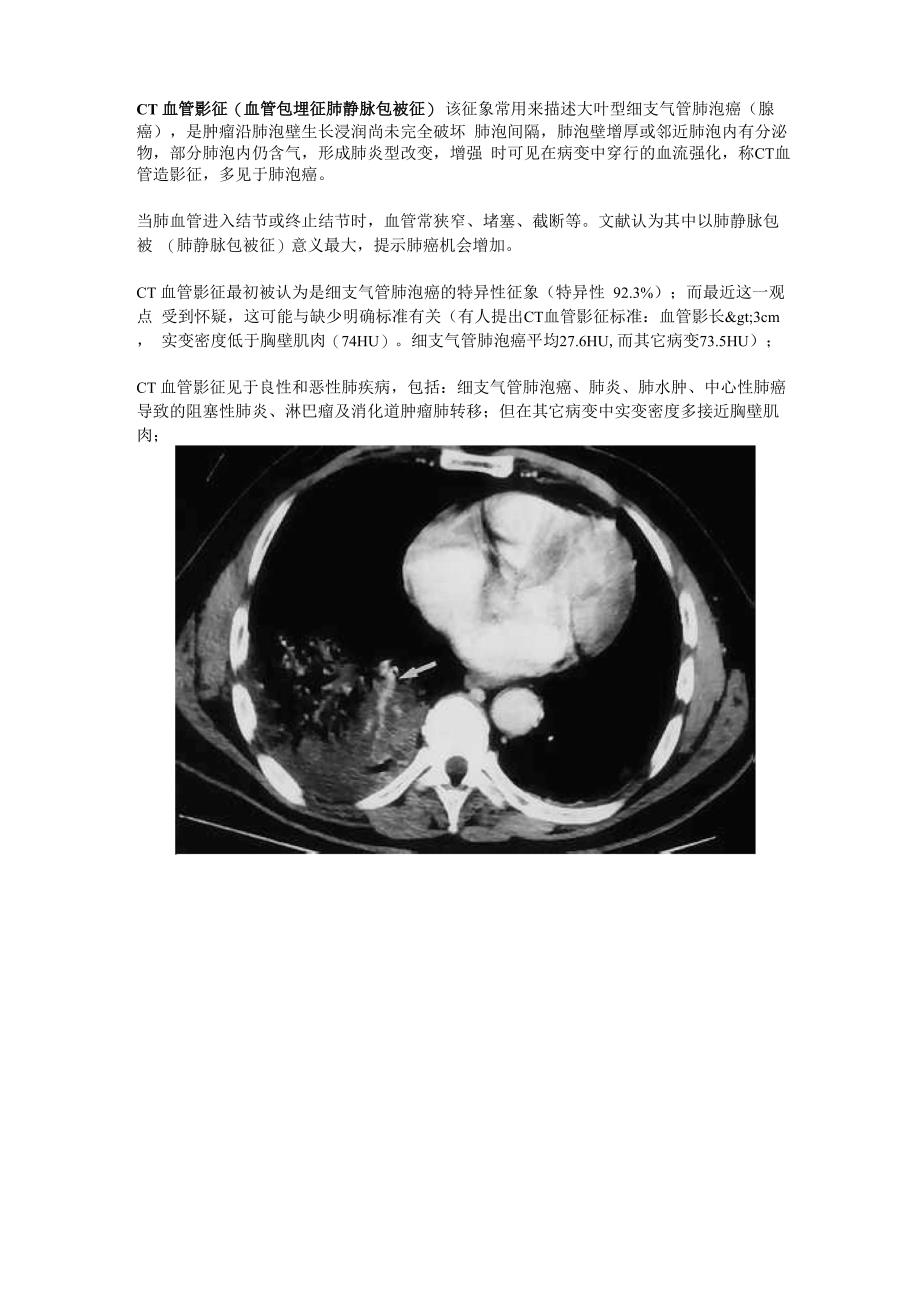 肺内基本病变_第1页