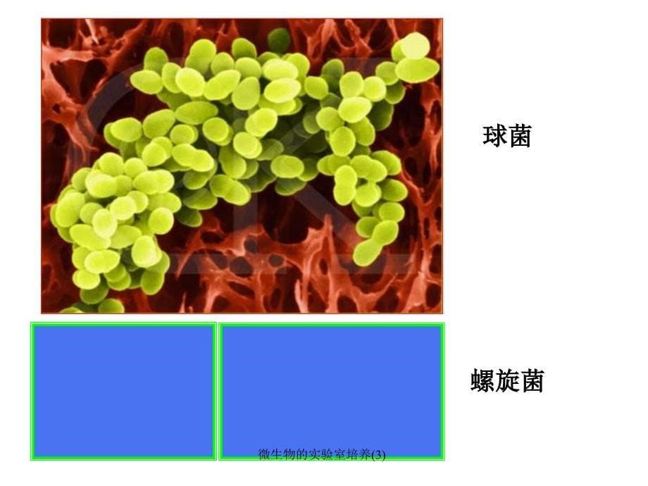 微生物的实验室培养3课件_第5页