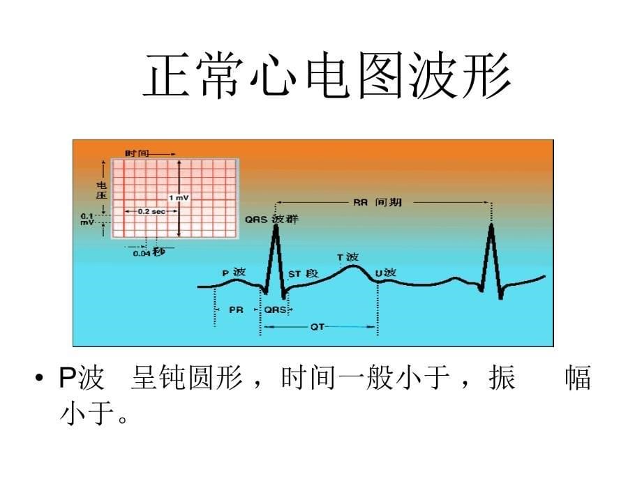 正常心电图波形特点PPT课件_第5页