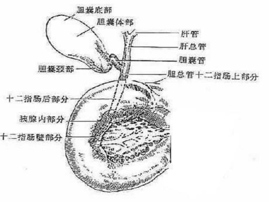 外科学第四十三章胆道疾病_第5页