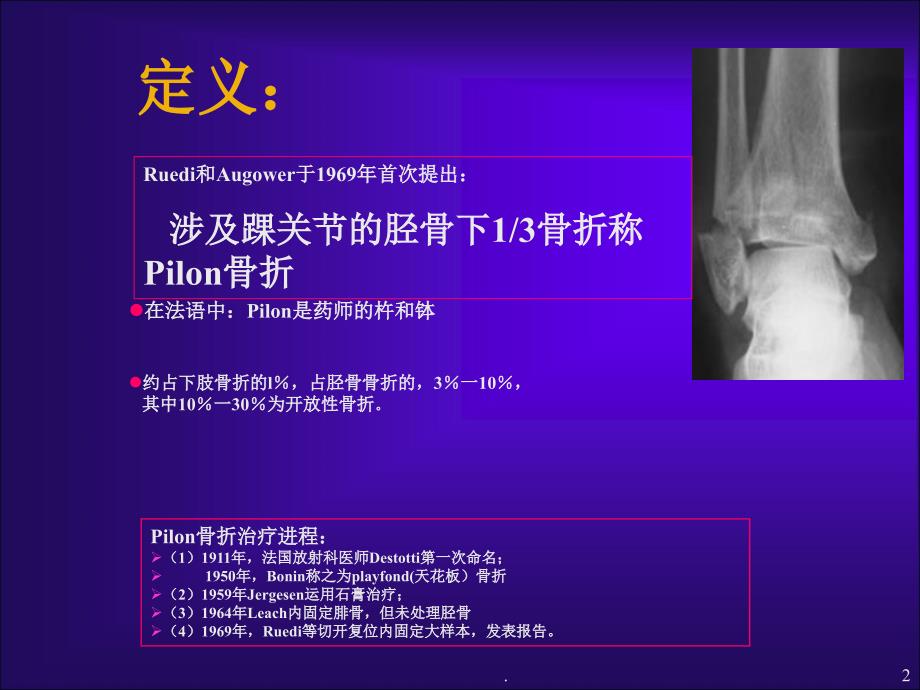 Pilon骨折的治疗ppt演示课件_第2页