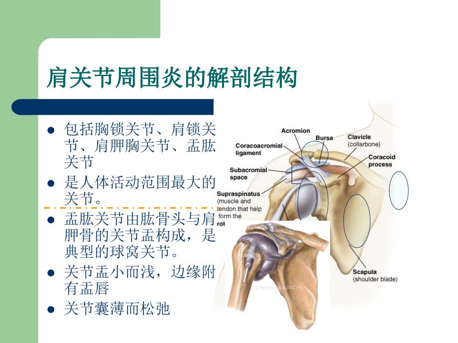 肩关节周围炎针灸治疗.ppt_第4页