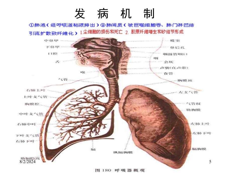 尘肺X线胸片阅读.PPT_第5页