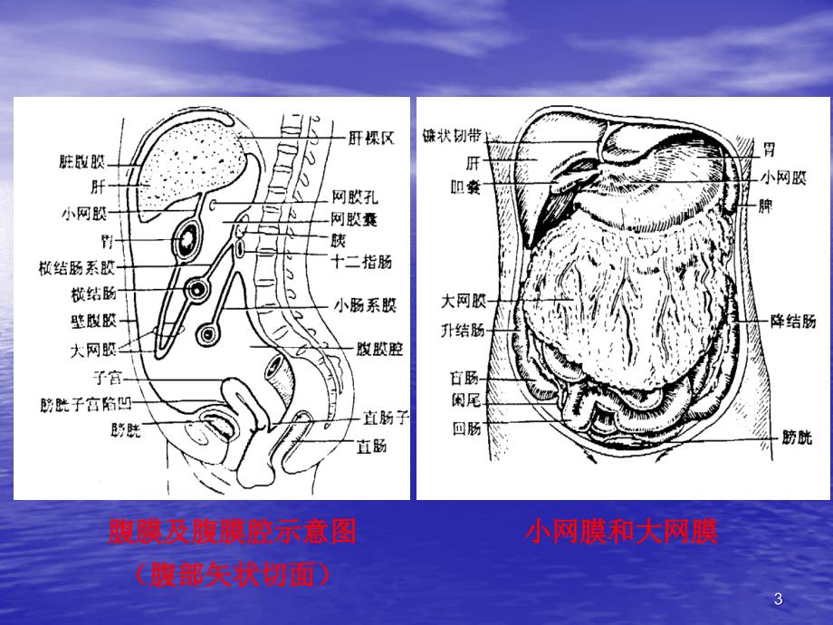 急性化脓性腹膜炎PPT课件_第3页