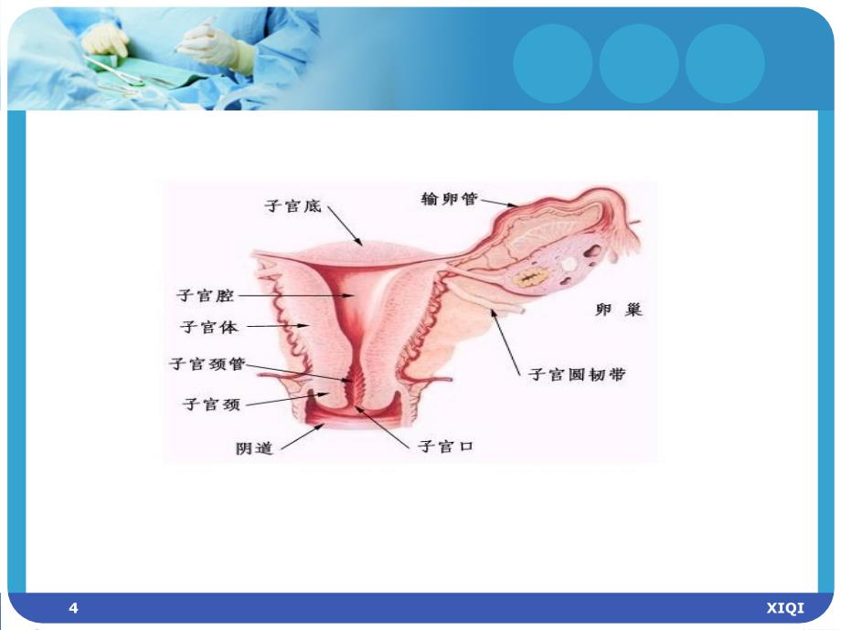 妇产科宫外孕护理查房(护理部)_第4页