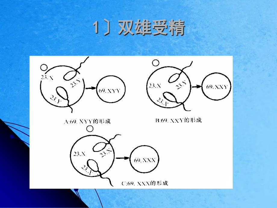 二节染色体畸变精选ppt课件_第4页