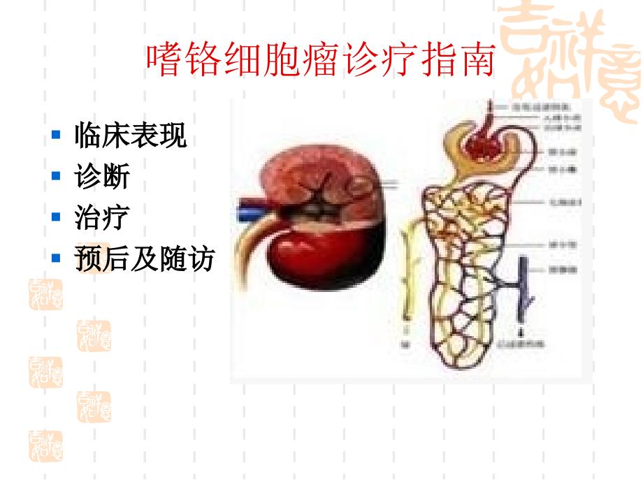 年嗜铬细胞瘤诊疗指南_第2页