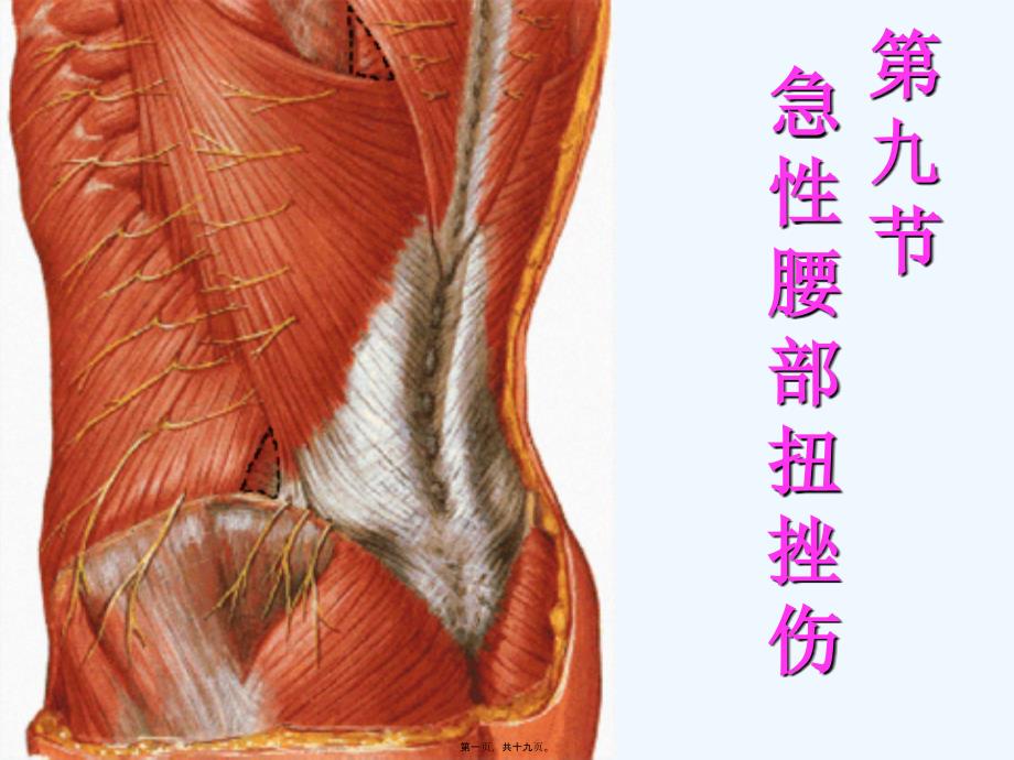 急性腰部扭挫伤课件_第1页