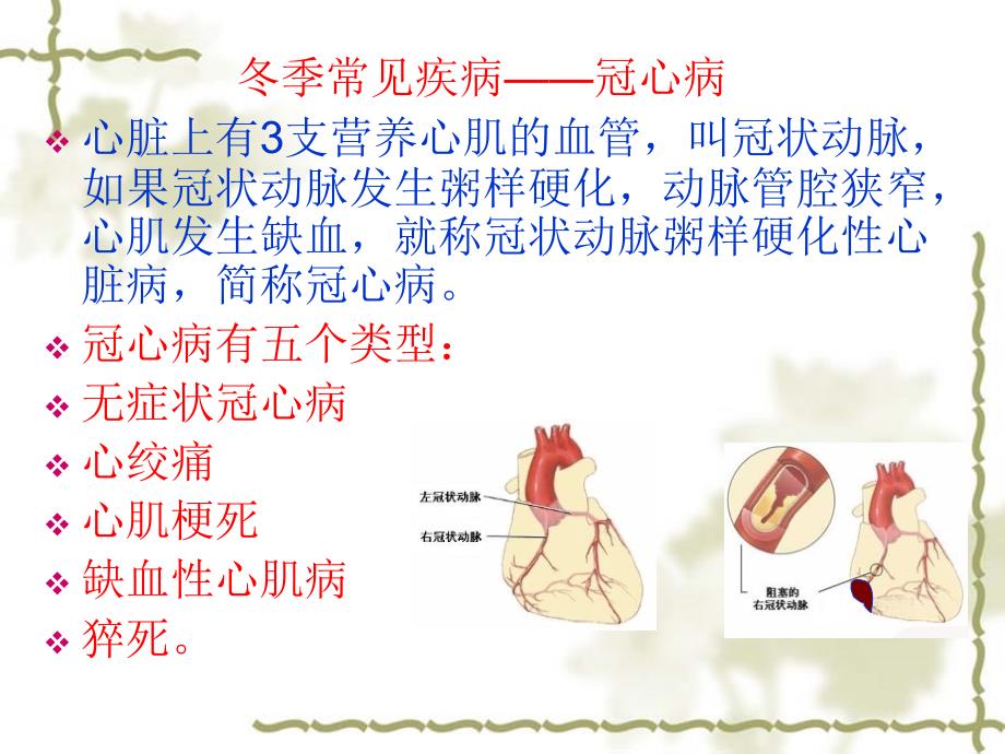 冬季中老年人常见疾病预防及保健课件_第3页