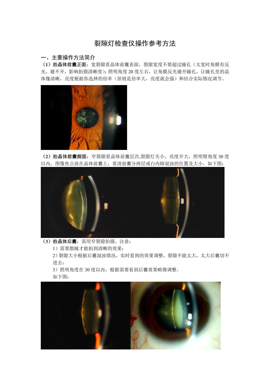 精品资料2022年收藏的裂隙灯操作方法_第1页