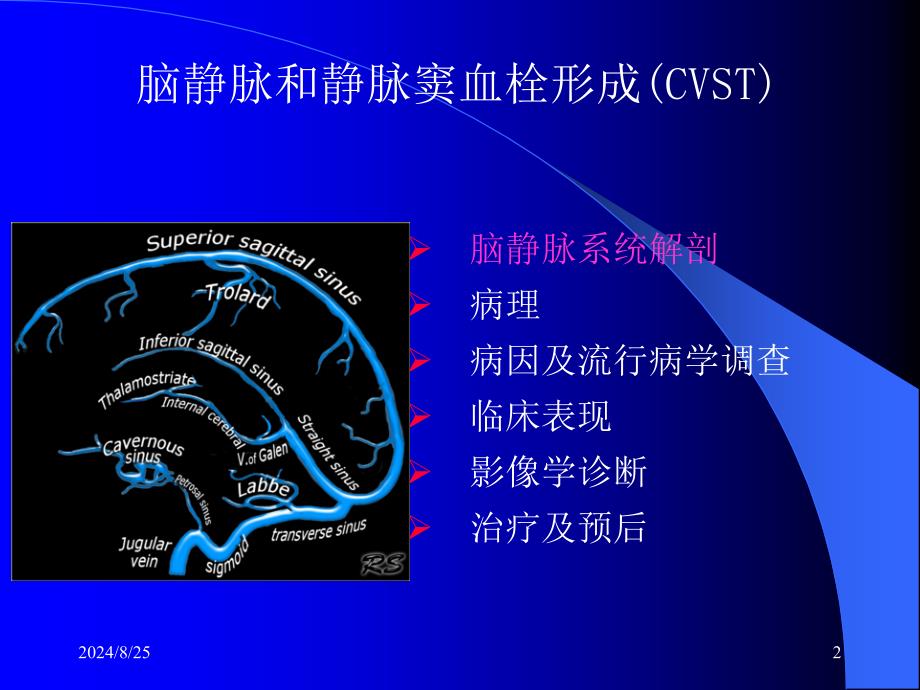 颅内静脉窦血栓形成_第2页