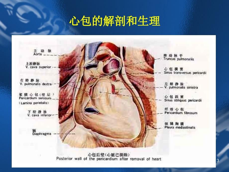 急性心包炎ppt课件_第3页