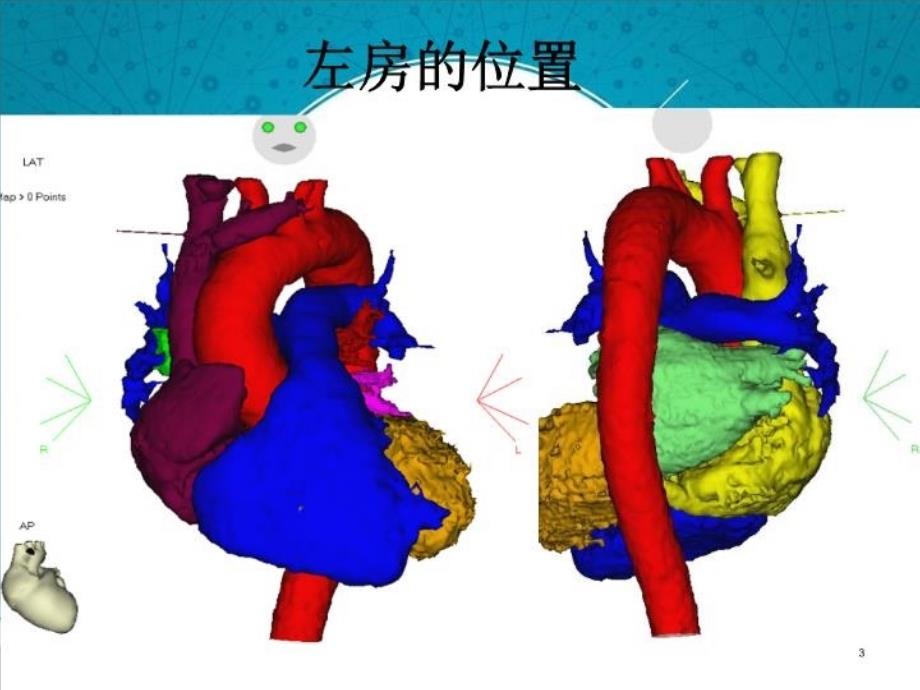 最新左房标测与消融PPT课件_第3页