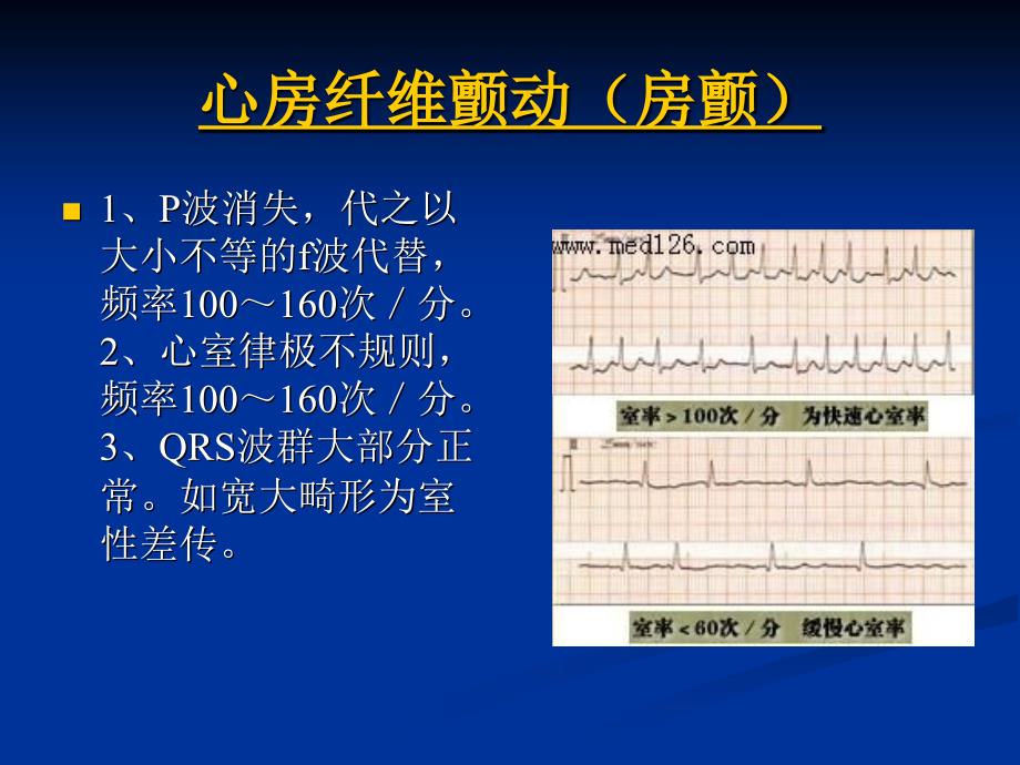 病理心电图表现_第1页