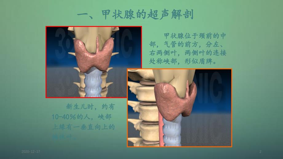 甲状腺超声诊断精品收藏_第2页