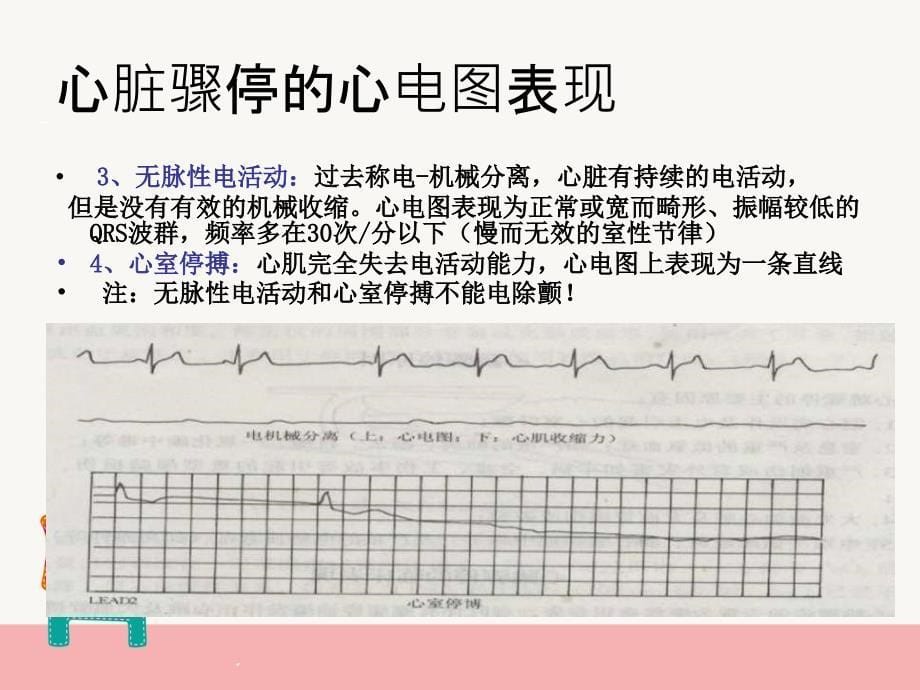 心肺复苏苗媛文档资料_第5页