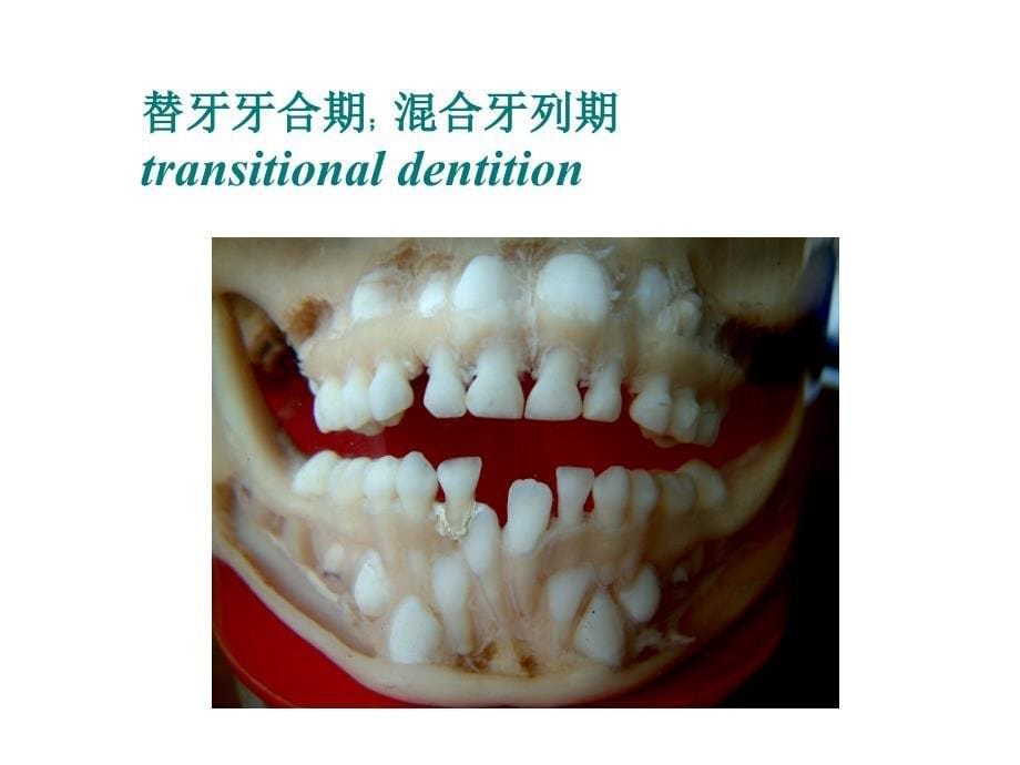 医学教学课件：第七节 乳牙外形_第5页