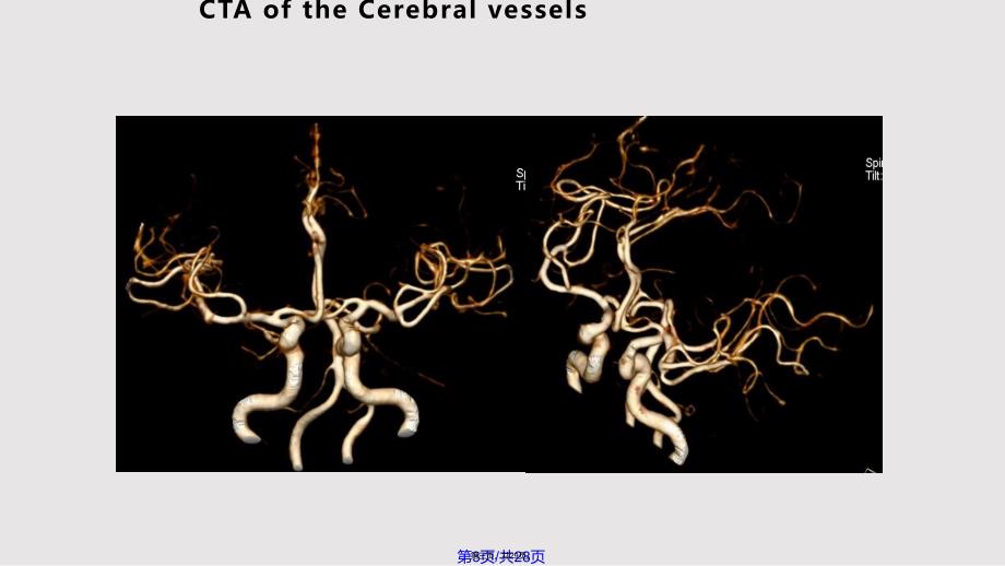 CT临床应用实用教案_第3页