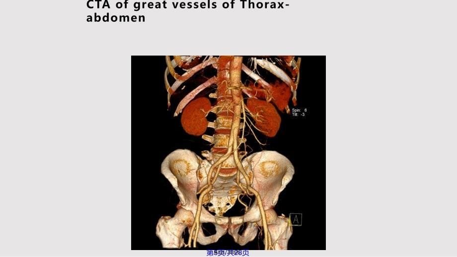 CT临床应用实用教案_第5页