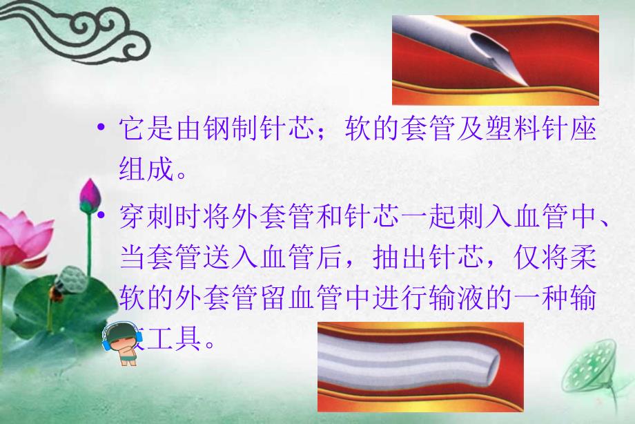 静脉留置针的穿刺技术及护理 ppt课件_第4页