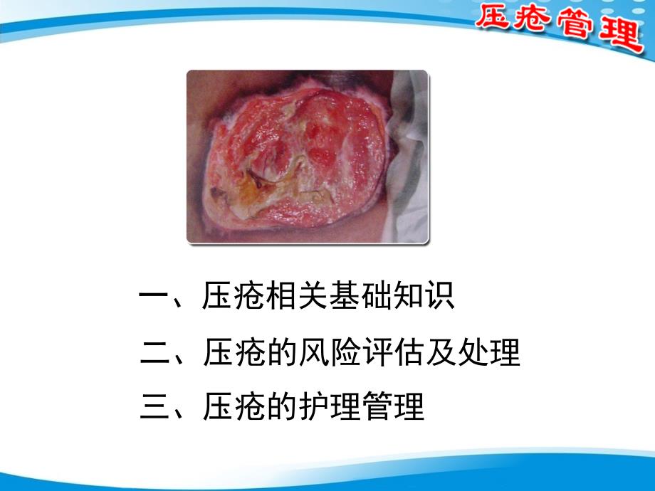 压疮管理课件.ppt_第2页