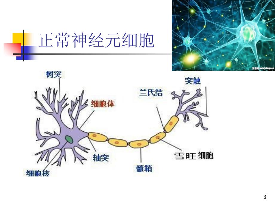 多发性硬化PowerPoint演示文稿_第3页