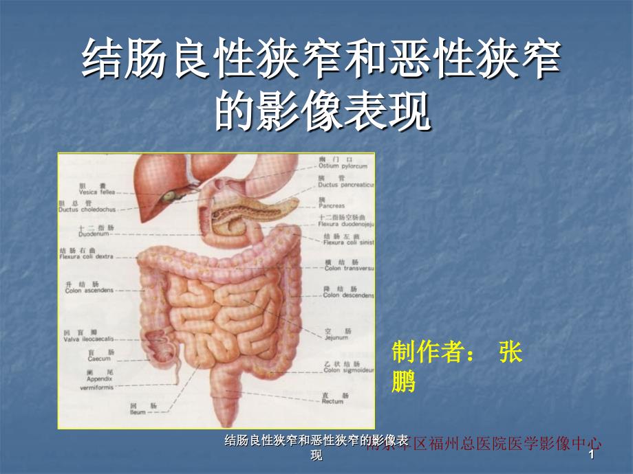 结肠良性狭窄和恶性狭窄的影像表现课件_第1页