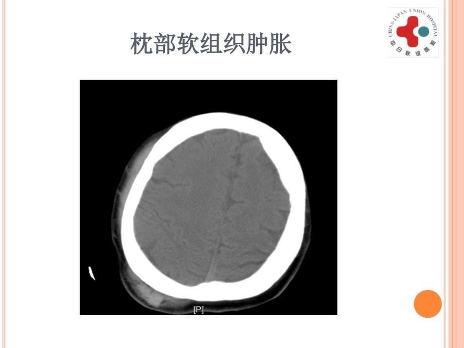 影像学3软组织精选文档_第5页